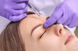 Botox kezelés homlok