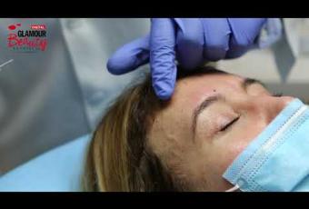 Embedded thumbnail for Botox kezelés a Bársonyban